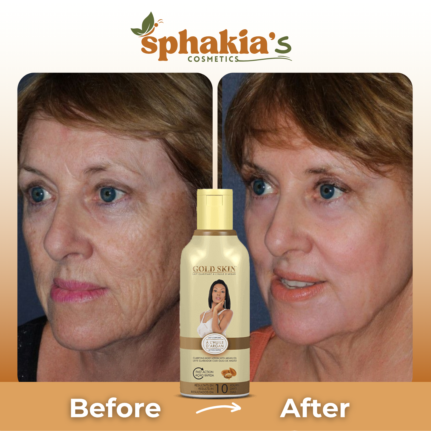 Before and after comparison of a woman's face with Sphakia's Gold Skin product displayed.
