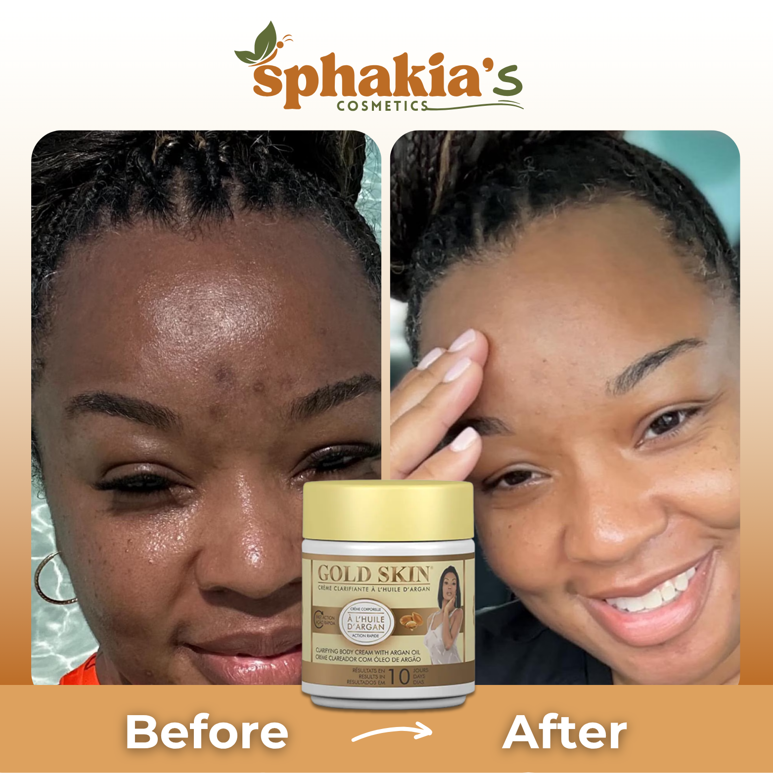 Before and after comparison of a woman's face with Sphakia's Gold Skin product, featuring the brand logo.