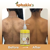 Before and after comparison of a bottle of Sphakia's Gold Skin product on a person's back.