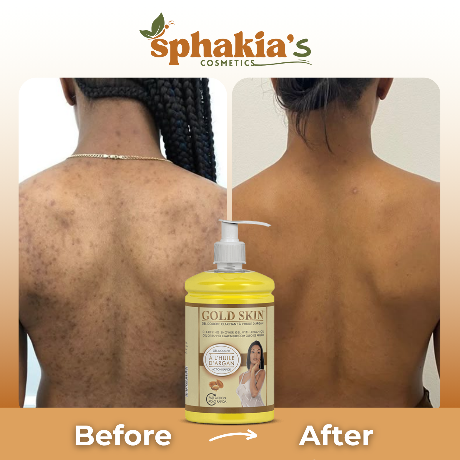 Before and after comparison of a bottle of Sphakia's Gold Skin product on a person's back.