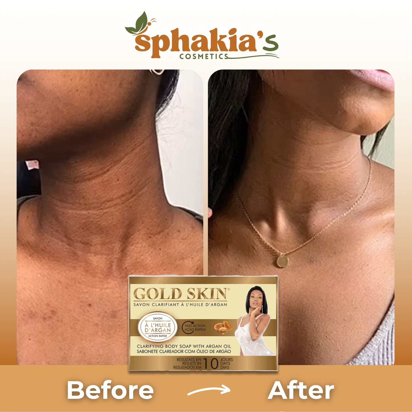 Before and after comparison of a woman's neck with Sphakia's Gold Skin product.