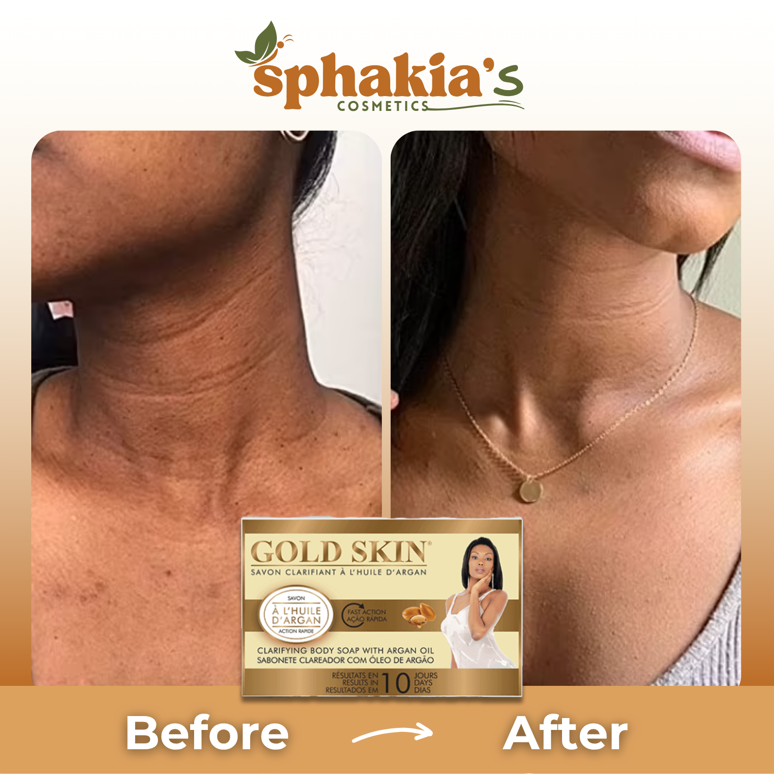 Before and after comparison of a woman's neck with Sphakia's Gold Skin product.